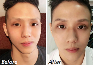before after 5